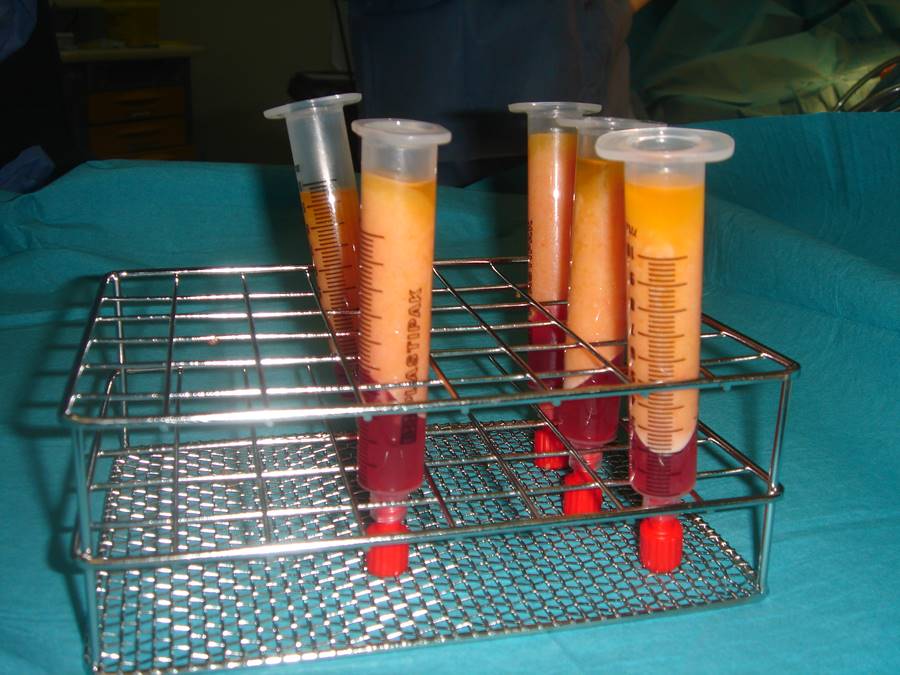 tarongicirugiaplastica mallorca